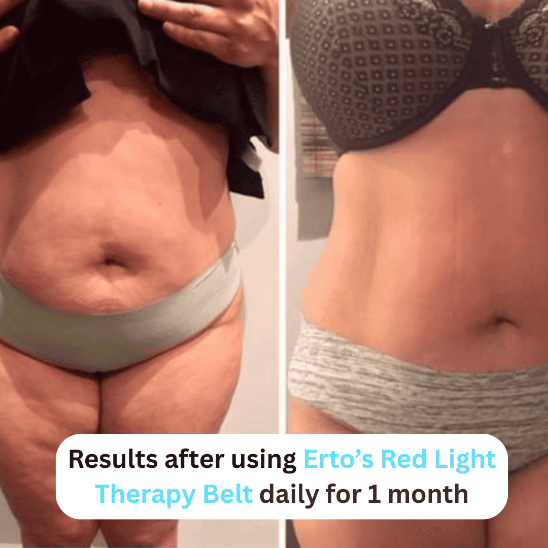 ERTO™ - Red Light Therapy Belt